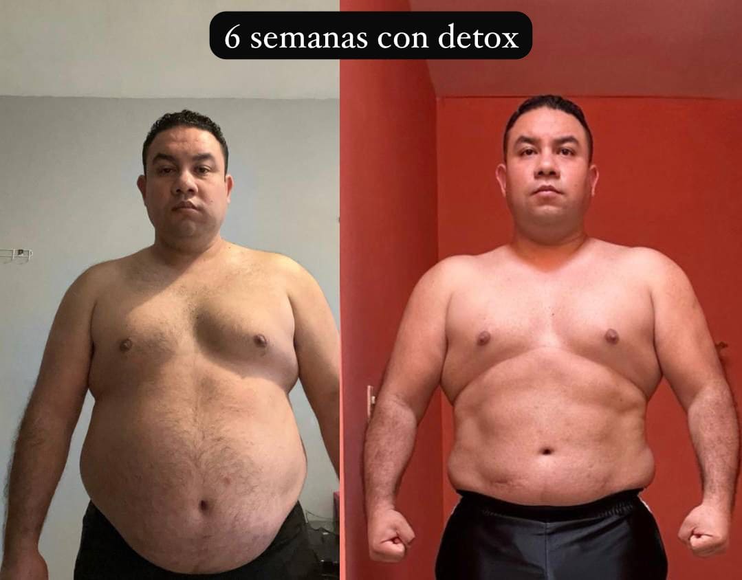 Antes y después - Carlos